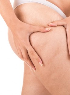 produit-minceur-fatgirlslim-de-bliss-cree-polemique-2907144110